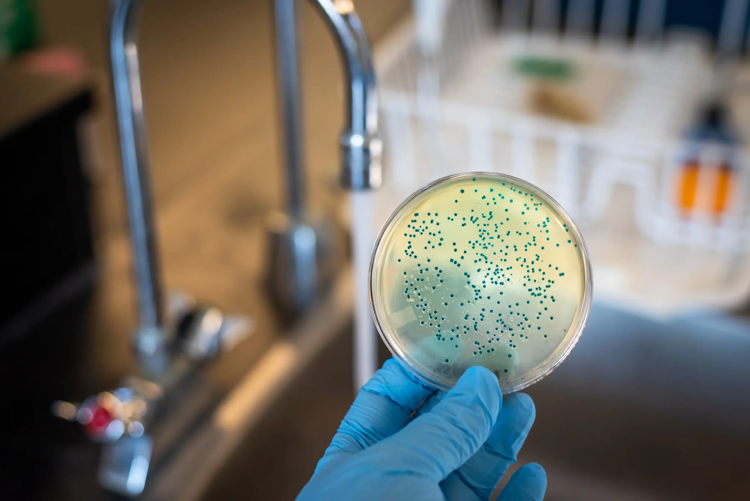 Controllo microbiologico dell’acqua potabile